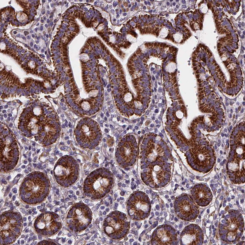Atlas Antibodies Anti-AEBP1 Antibody
