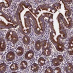 Atlas Antibodies Anti-AEBP1 Antibody