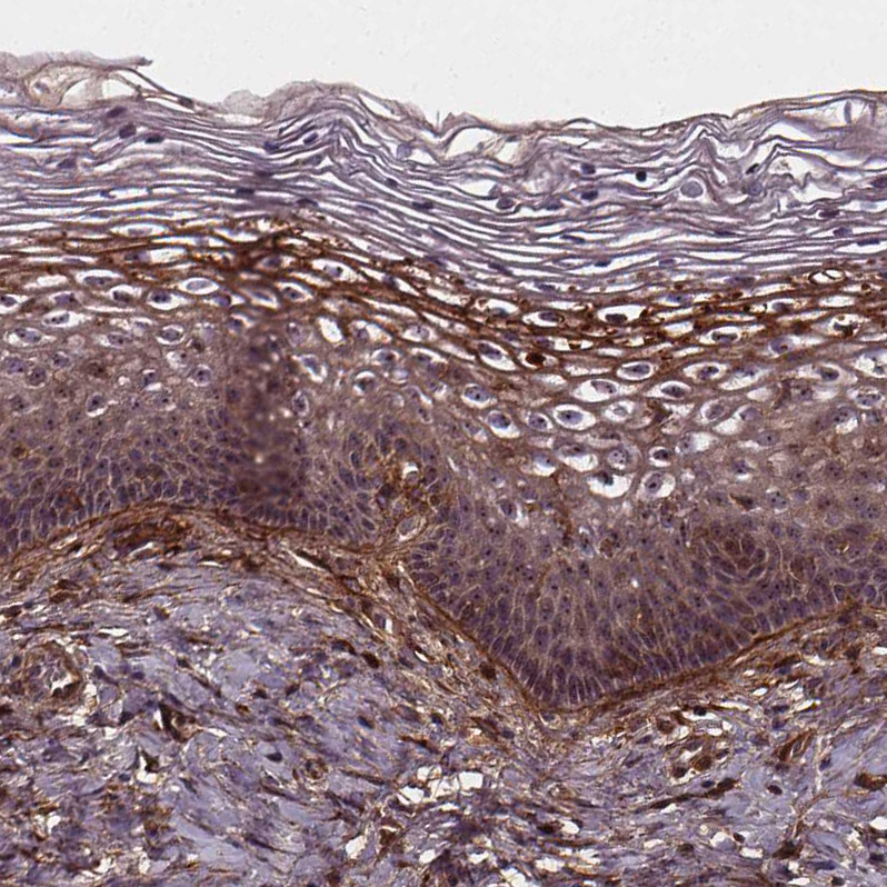 Atlas Antibodies Anti-AEBP1 Antibody