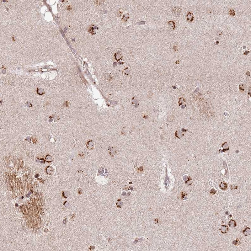 Atlas Antibodies Anti-AF165138.7 Antibody