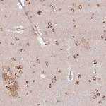 Atlas Antibodies Anti-AF165138.7 Antibody