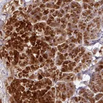Atlas Antibodies Anti-AEBP2 Antibody