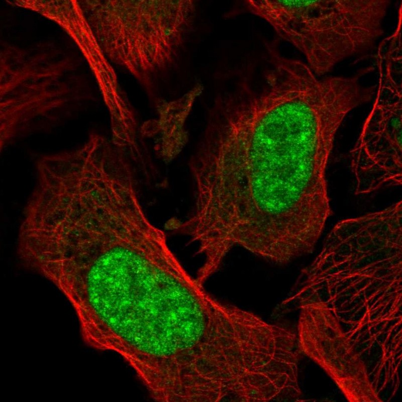 Atlas Antibodies Anti-AES Antibody