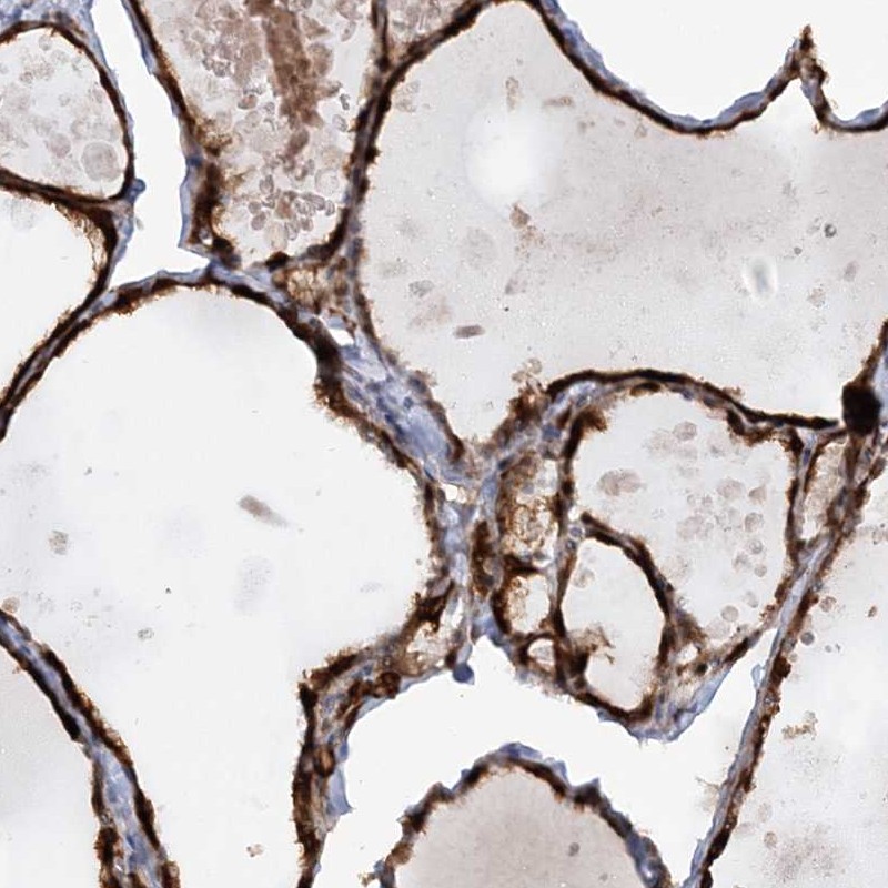 Atlas Antibodies Anti-AFAP1L2 Antibody