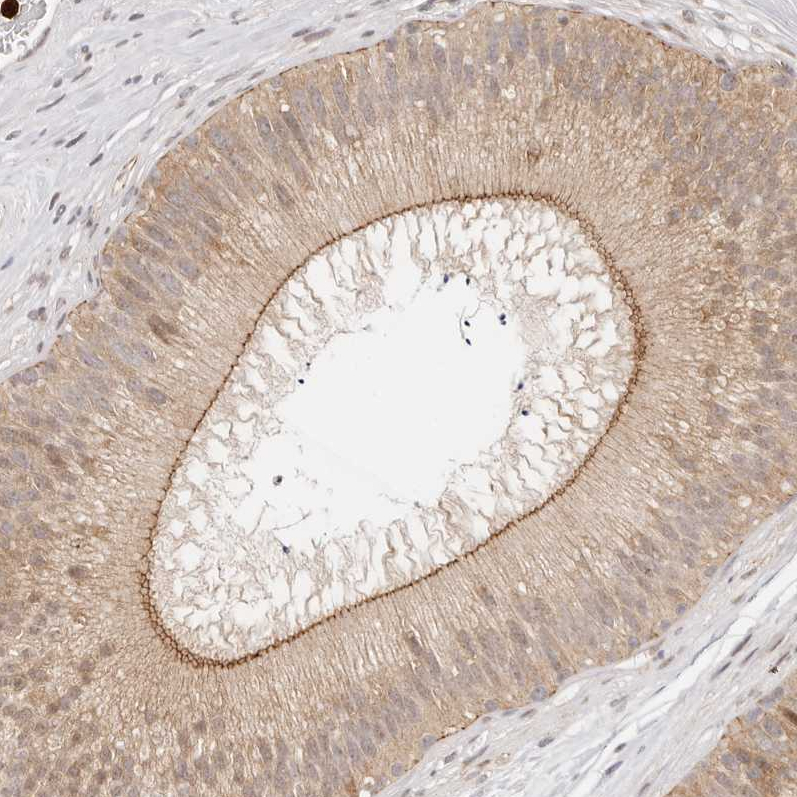 Atlas Antibodies Anti-AFDN Antibody