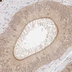 Atlas Antibodies Anti-AFDN Antibody
