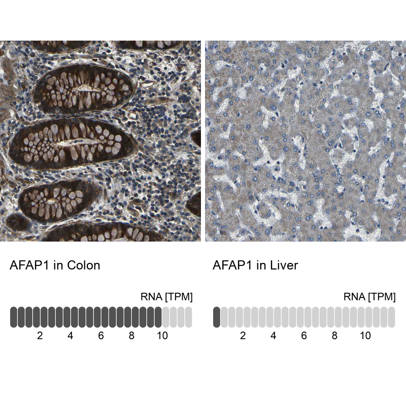 Atlas Antibodies Anti-AFAP1 Antibody