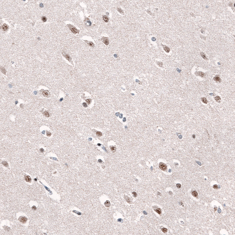 Atlas Antibodies Anti-AFF2 Antibody