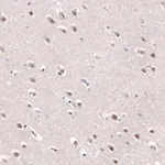 Atlas Antibodies Anti-AFF2 Antibody