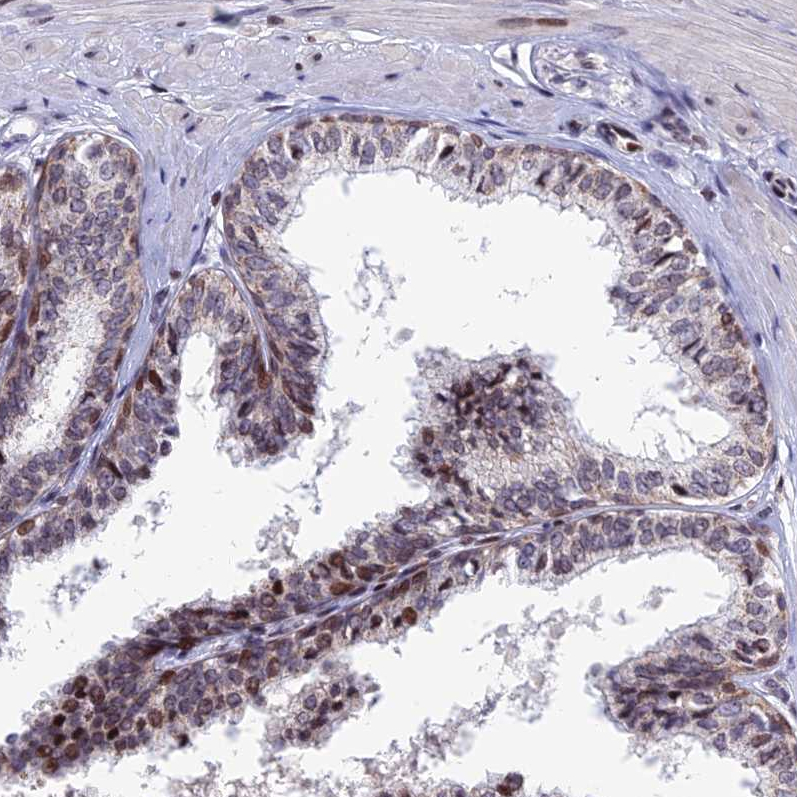 Atlas Antibodies Anti-AFF3 Antibody