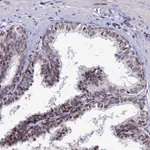 Atlas Antibodies Anti-AFF3 Antibody