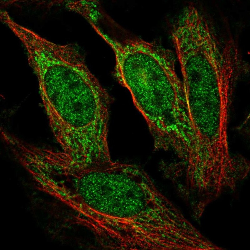 Atlas Antibodies Anti-AFF1 Antibody