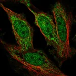 Atlas Antibodies Anti-AFF1 Antibody