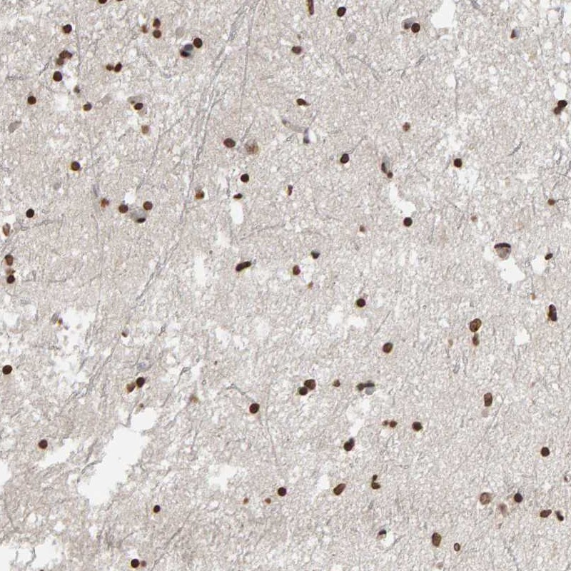Atlas Antibodies Anti-AFF4 Antibody