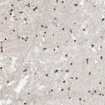 Atlas Antibodies Anti-AFF4 Antibody