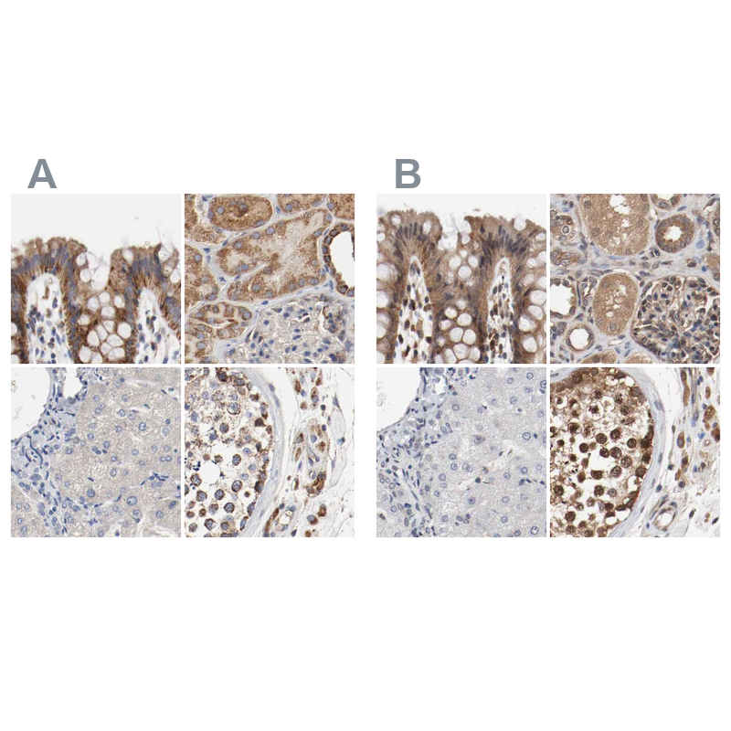 Atlas Antibodies Anti-AFG3L2 Antibody