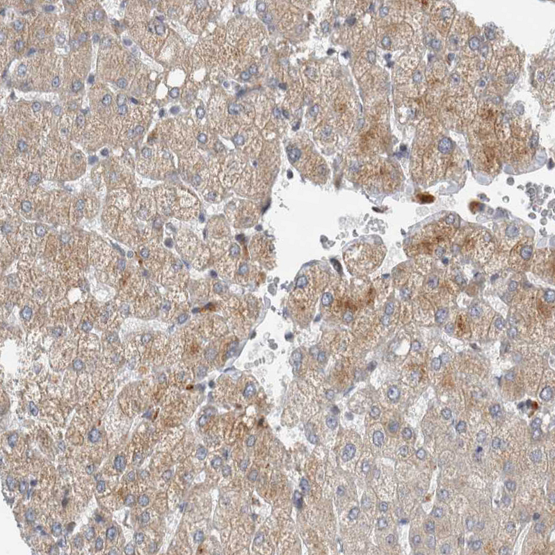 Atlas Antibodies Anti-AFP Antibody