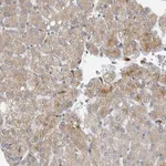 Atlas Antibodies Anti-AFP Antibody