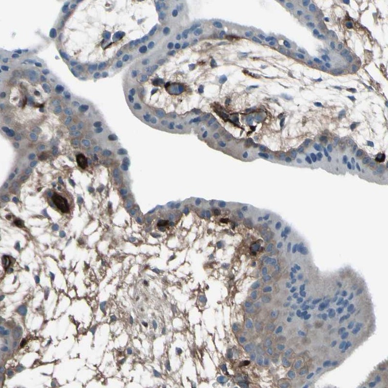Atlas Antibodies Anti-AFP Antibody