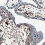 Atlas Antibodies Anti-AFP Antibody