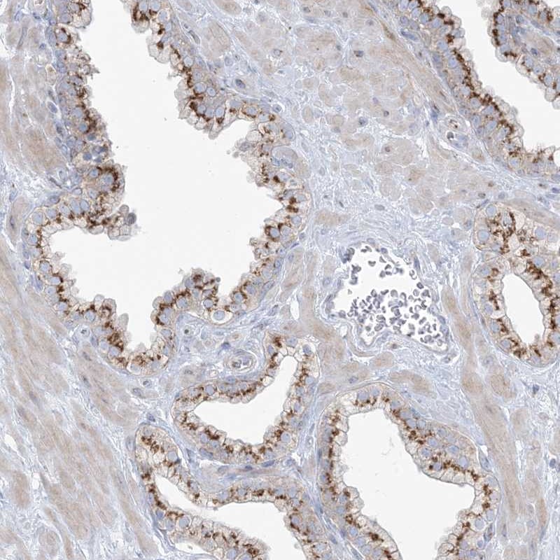 Atlas Antibodies Anti-AFTPH Antibody