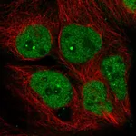 Atlas Antibodies Anti-AFF4 Antibody