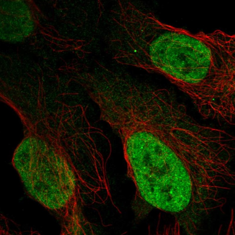 Atlas Antibodies Anti-AFF3 Antibody