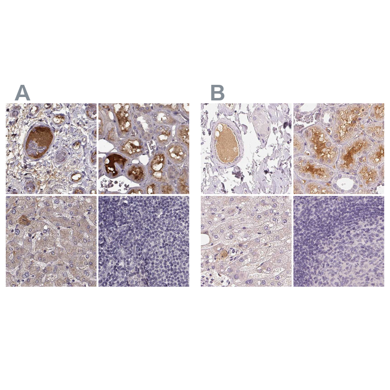 Atlas Antibodies Anti-AFM Antibody