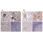 Atlas Antibodies Anti-AFM Antibody