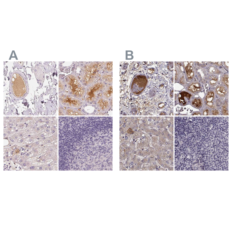 Atlas Antibodies Anti-AFM Antibody