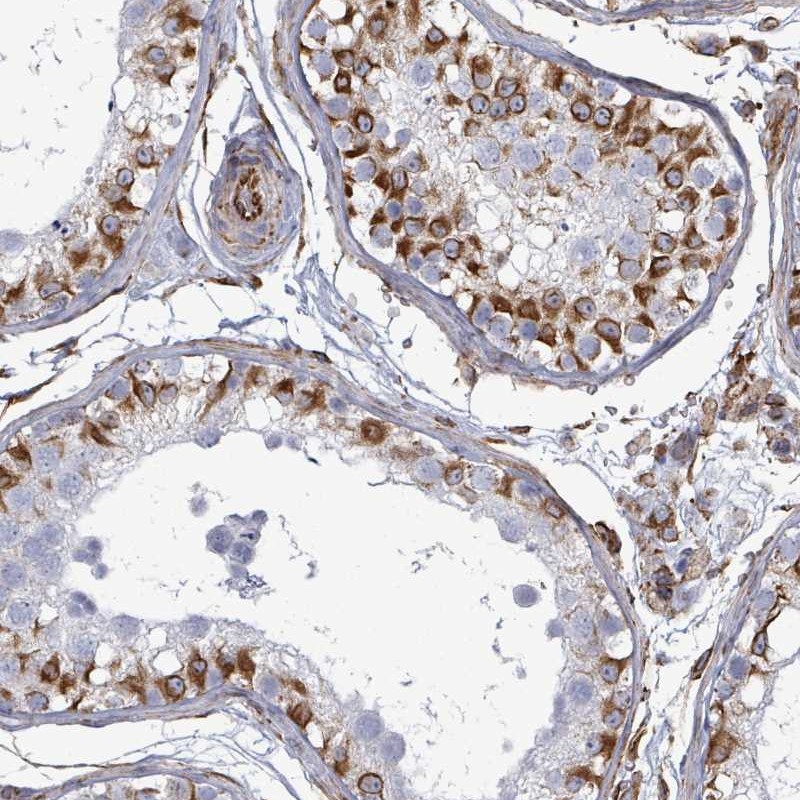 Atlas Antibodies Anti-AGAP1 Antibody