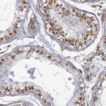 Atlas Antibodies Anti-AGAP1 Antibody