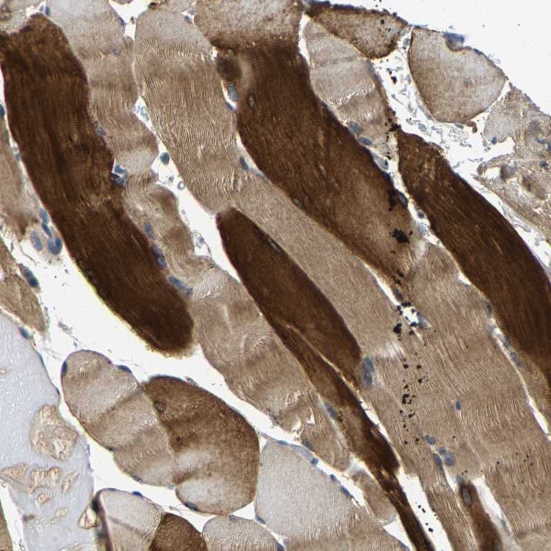 Atlas Antibodies Anti-AGBL3 Antibody