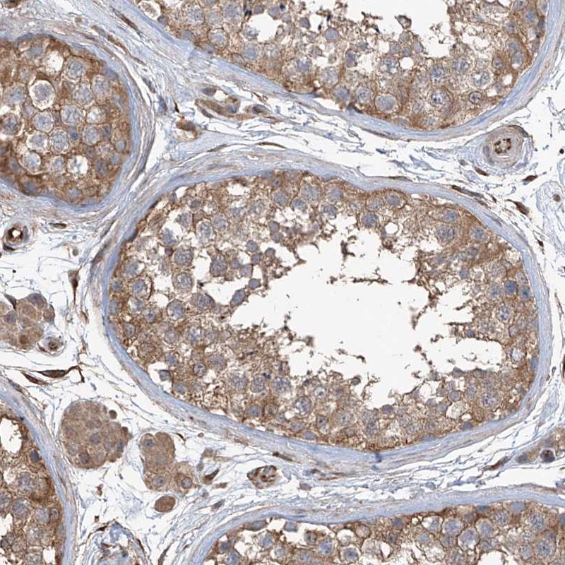 Atlas Antibodies Anti-AGBL5 Antibody