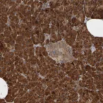 Atlas Antibodies Anti-AGBL3 Antibody