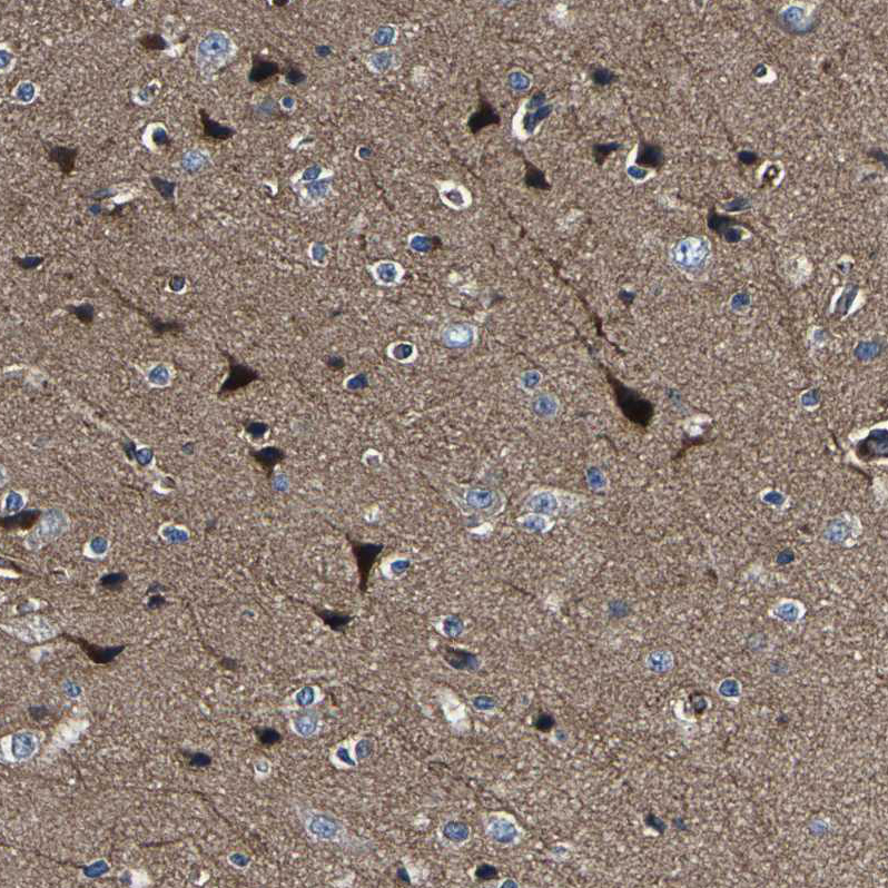 Atlas Antibodies Anti-AGAP3 Antibody
