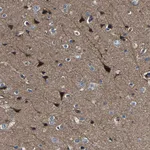 Atlas Antibodies Anti-AGAP3 Antibody