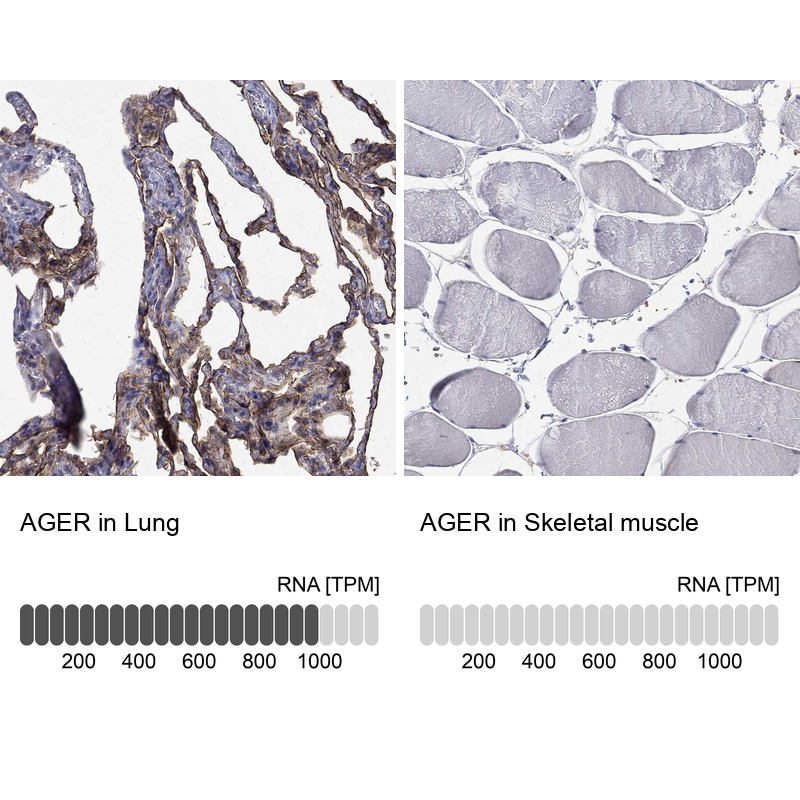 Atlas Antibodies Anti-AGER Antibody