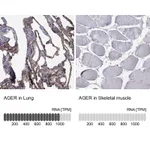 Atlas Antibodies Anti-AGER Antibody