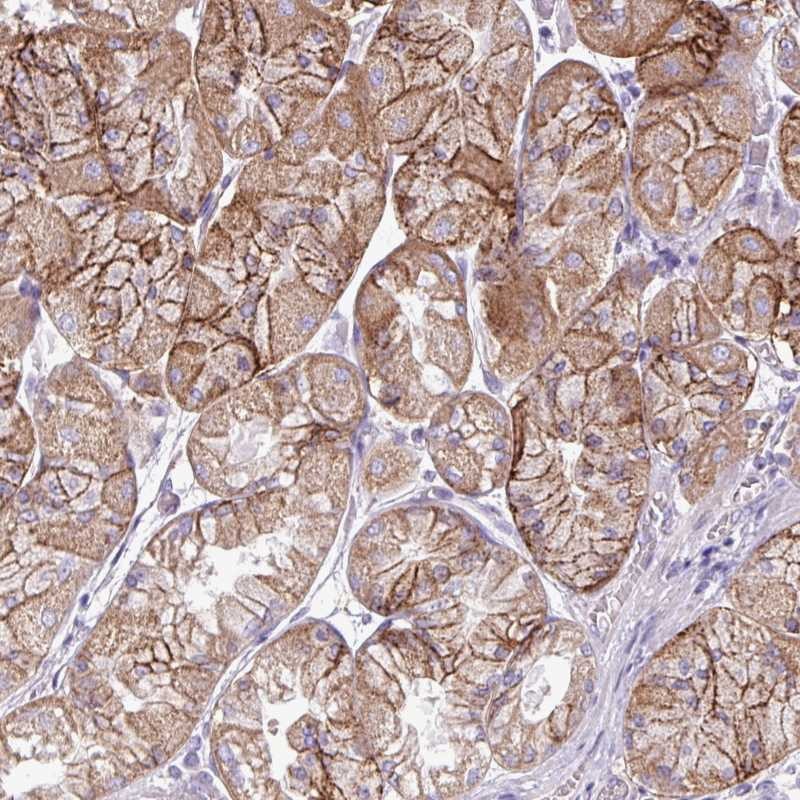 Atlas Antibodies Anti-AGAP4 Antibody