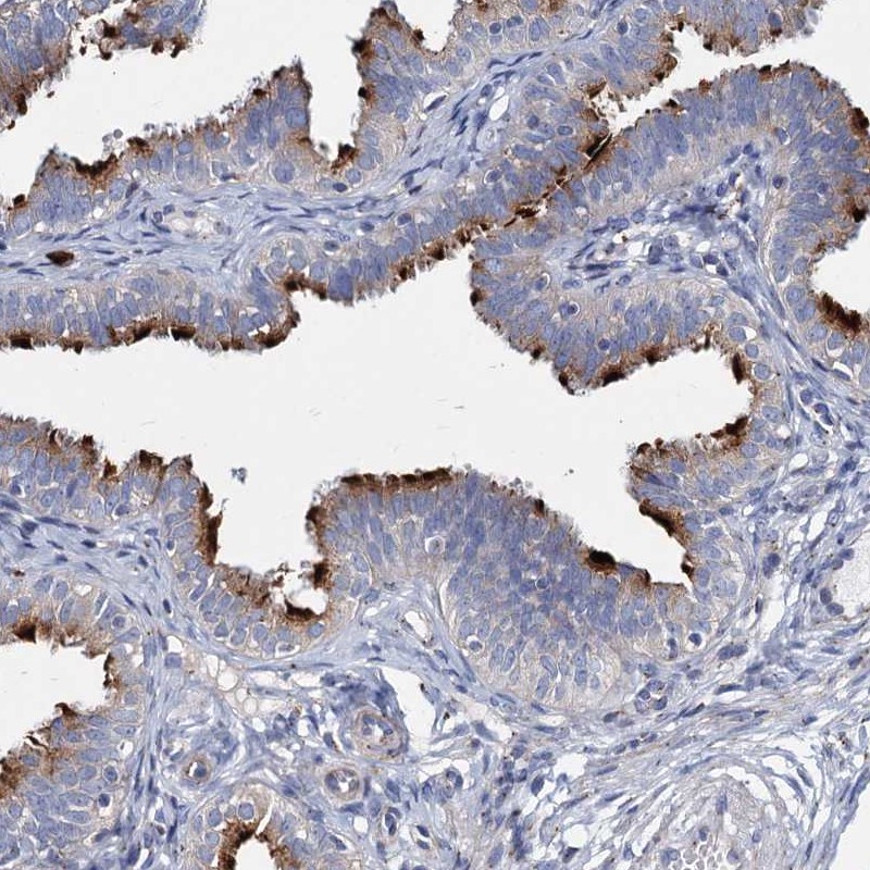 Atlas Antibodies Anti-AGBL4 Antibody