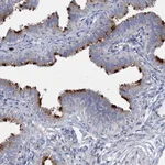 Atlas Antibodies Anti-AGBL4 Antibody