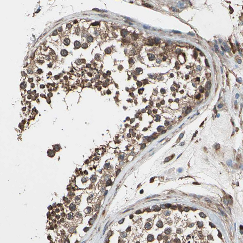 Atlas Antibodies Anti-AGBL2 Antibody