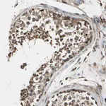 Atlas Antibodies Anti-AGBL2 Antibody