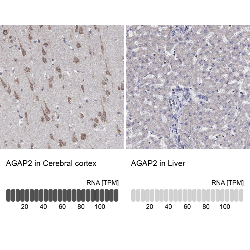 Atlas Antibodies Anti-AGAP2 Antibody