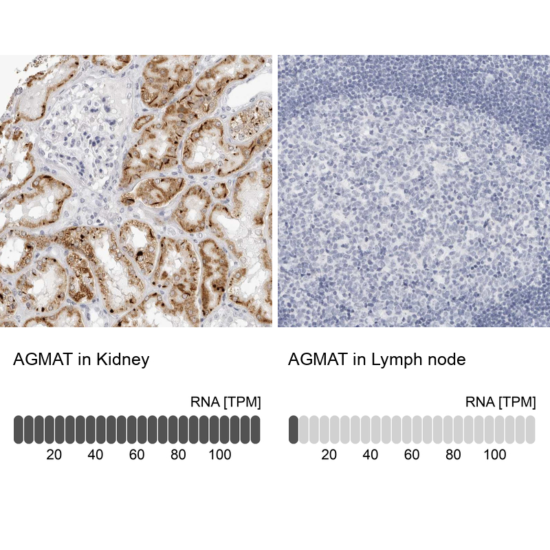 Atlas Antibodies Anti-AGMAT Antibody
