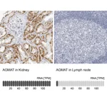Atlas Antibodies Anti-AGMAT Antibody
