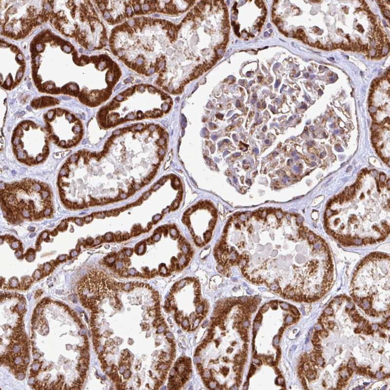 Atlas Antibodies Anti-AGK Antibody