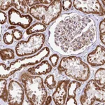 Atlas Antibodies Anti-AGK Antibody