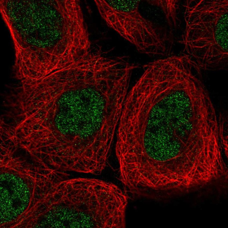 Atlas Antibodies Anti-AGL Antibody